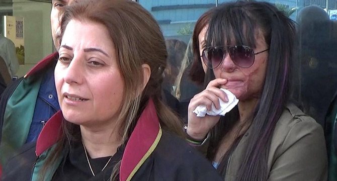 Yüzüne asit atılan Berfin: Kadına şiddet son bulsun
