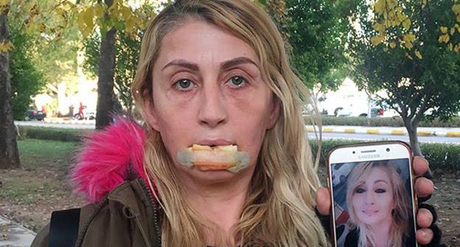 Güzellik uğruna hayatı karardı