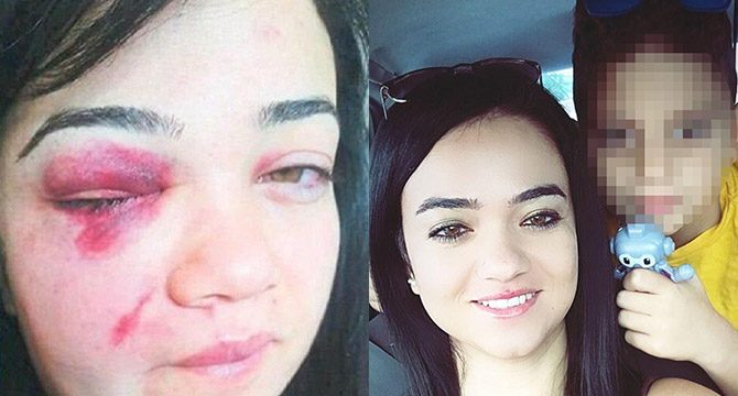 Şiddet gören Zeliha'ya oğlundan acı uyarı: Topuklu giyme, babam görürse kaçamazsın