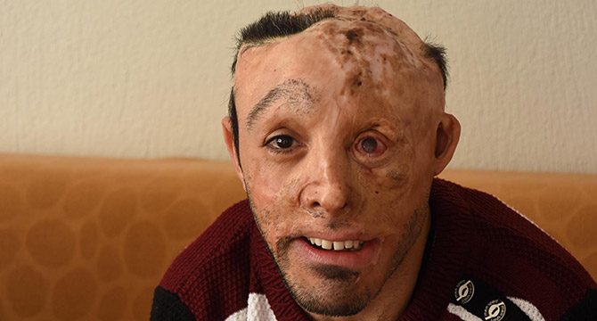 Mehmet Ali'yi ameliyat edecek doktorlar aranıyor