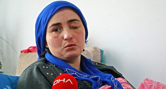 Eşinin şiddetiyle gözünü kaybeden Elif: Dünyamı kararttı, ışığa hasret kalsın