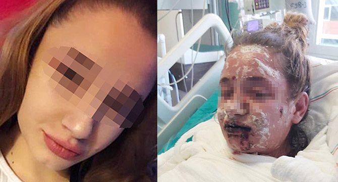 Sınav kaygısı için aldığı ilaç, vücudunu yakıp, görme yetisini kaybettirdi
