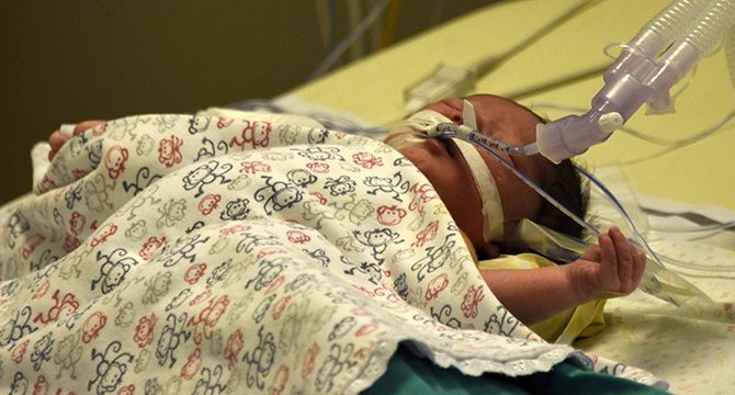 Muhammet İsmail bebek, 100 dakika kalbi durdurularak ameliyat edildi