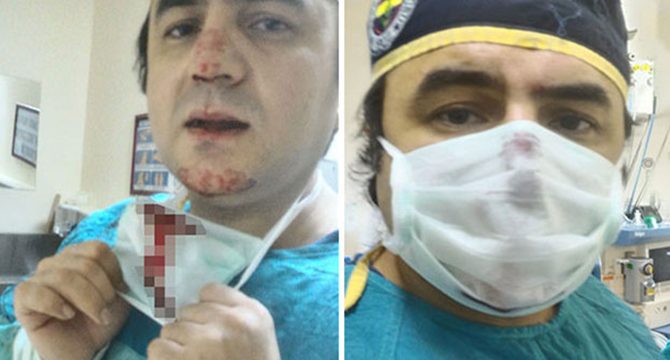 Hastanede doktorun burnunun kırıldığı saldırının görüntüsü çıktı