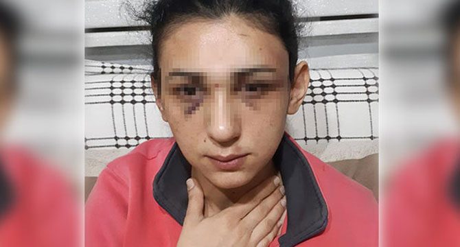 Genç kadının yardım çığlığı