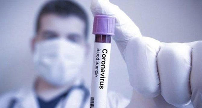 Koronavirüs salgınında ölü sayısı 18 bin 919&#39;a yükseldi | Korkusuz Gazetesi