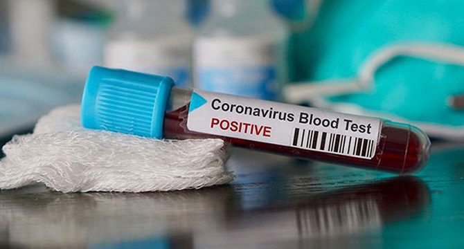 Koronavirüsle savaşan hemşire hayatını kaybetti