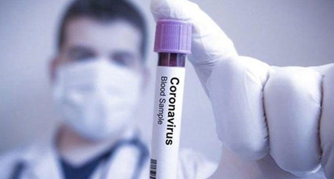 İngiltere'de son 24 saatte koronavirüsten 684 ölüm