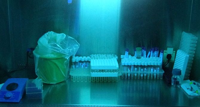 Koronavirüsle mücadelede 'ultraviyole ışınlı temizlik' uyarısı