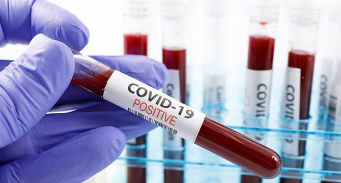 Dünya genelinde koronavirüs bilançosu: Can kaybı 451 bin 439’a yükseldi