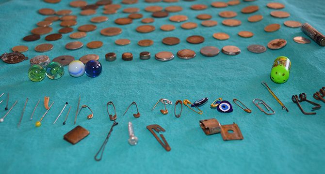 Elazığ'da, çocukların yuttuğu cisimler hastanede sergilendi