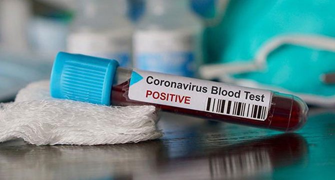 Koronavirüs hastası uçağa bindi, 12 kişi karantinaya alındı