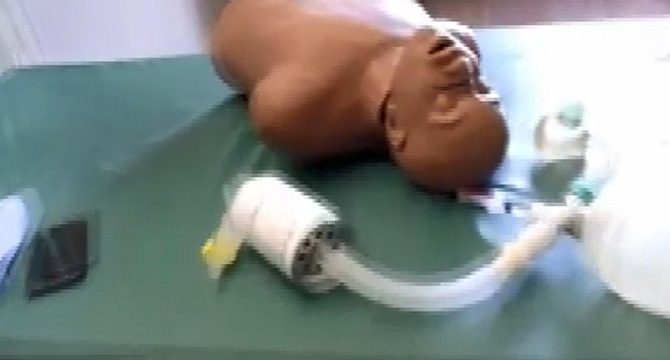 Japon doktordan e-posta ile gönderilen ve üretilebilen solunum cihazı