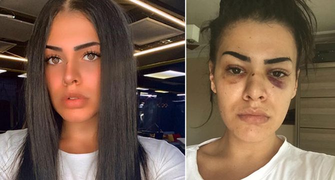 Genç kadının darp edilmesi olayında şüpheli serbest bırakıldı