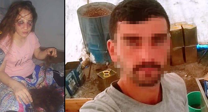 Boşanma aşamasındaki eşi, çocuklarının gözü önünde dövüp, saçlarını kesti