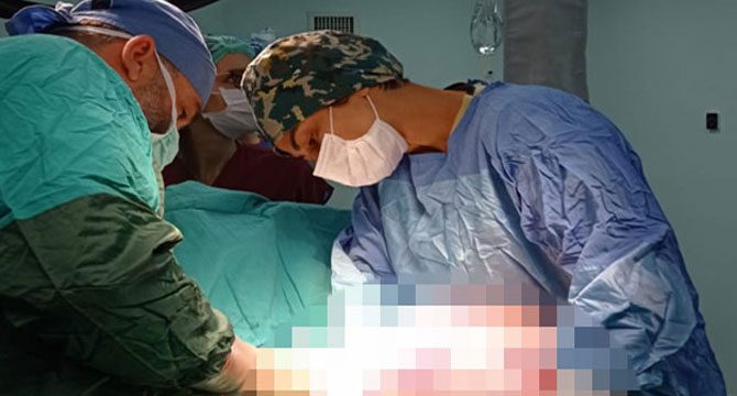 Şişkinlik diye gitti karnından 5.5 kilo tümör çıktı