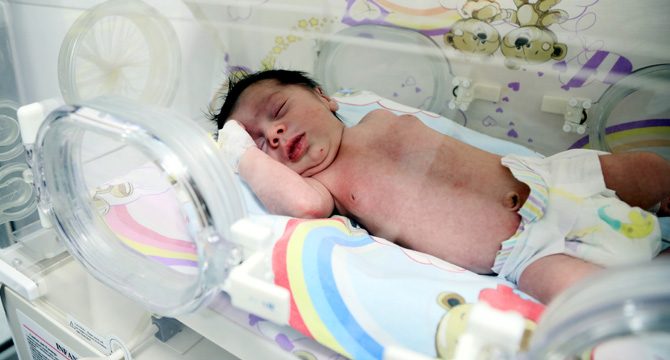 Muammer bebek tüm organları ters doğdu