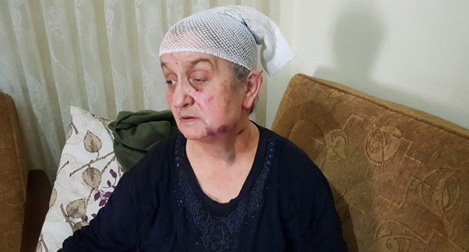 Komşusu yaşlı kadını darp edip bileziklerini çaldı