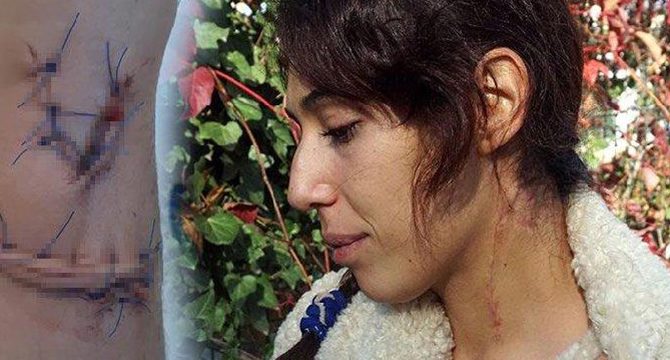 Eski eşinin boğazını kesip, 5 kez bıçaklayan sanık: Yanlış anlaşılma oldu