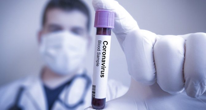 Mutasyon geçiren virüs Nijerya'ya sıçradı