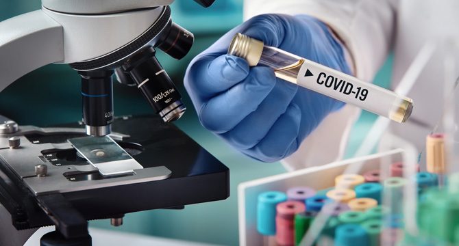 Sağlık Bakanlığı duyurdu! 'Covid-19 Takip Merkezleri' açılıyor