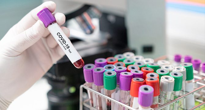 Covid-19'un mutasyona uğradığı İngiltere'ye o ülkelerden seyahat yasağı