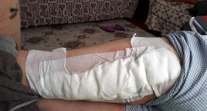 Yaban domuzu saldıran çiftçinin bacağına 60 dikiş atıldı