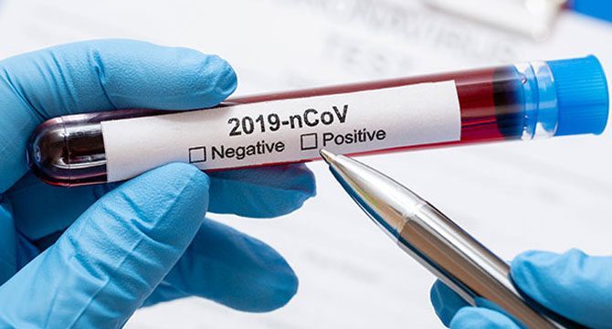O ülkede evden çıkmak için negatif Covid-19 testi şartı