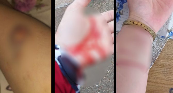 Eski eşinden şiddet gördüğünü anlattı! Saatler sonra öldüğünü öğrendi