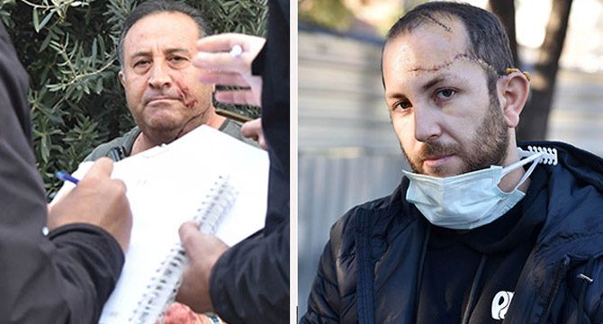 Damadını ağır yaralayan kayınpeder ilk duruşmada tahliye oldu