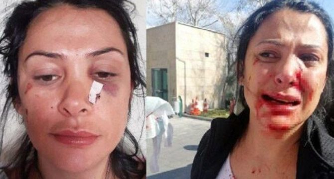Öğretmen dehşet saçtı: Kalemi yüzüne sapladı