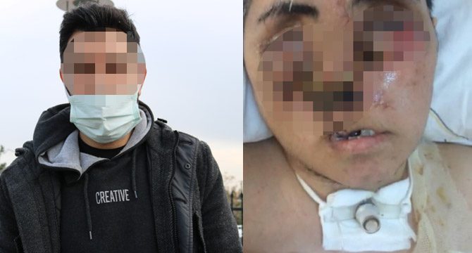 Dehşet! Eşini öldürdü, baldızını bu hale getirdi