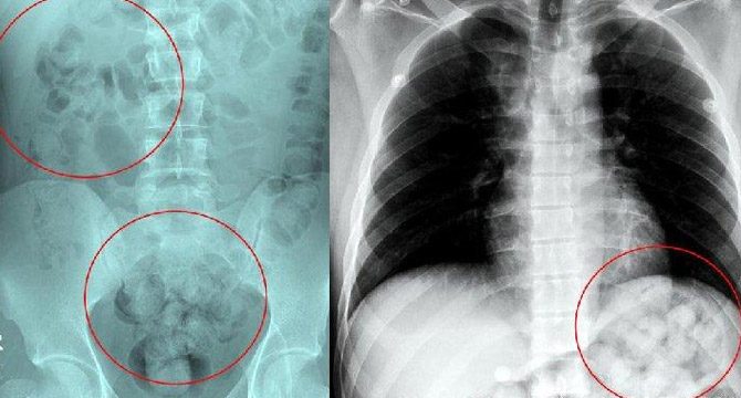 Doktorlar şaşkına döndü! Zehirlenince yakayı ele verdi