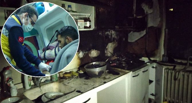 Tek isteği patates kızartmaktı! Neredeyse canından oluyordu