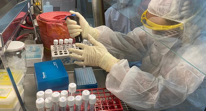 Sinovac aşısında yüzde 99,6 oranında antikor yanıtı saptandı