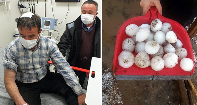 Ceviz büyüklüğündeki dolu hastanelik etti