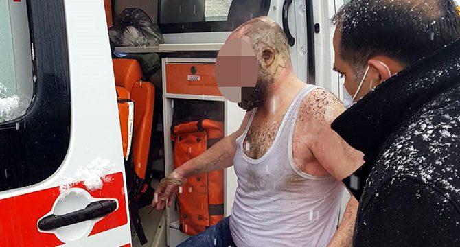 Ailesiyle tartışan kepçe operatörü, kendini yaktı