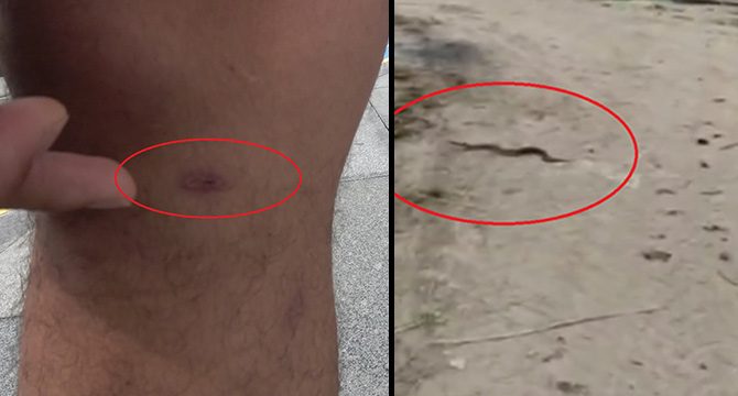 Bisiklet kullanırken yılan saldırısına uğradı