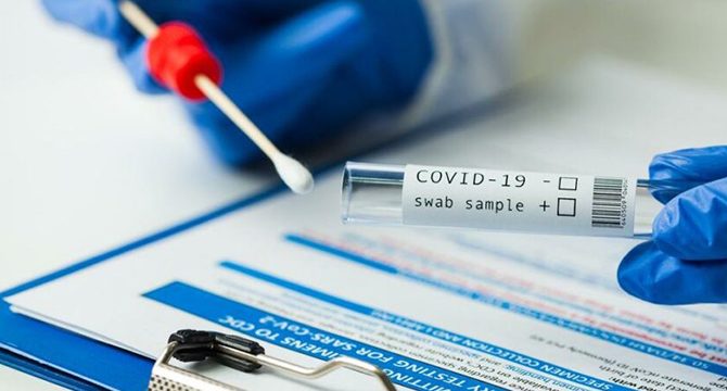 Ukrayna’dan mutasyona karşı 4 ülkeye PCR testi şartı