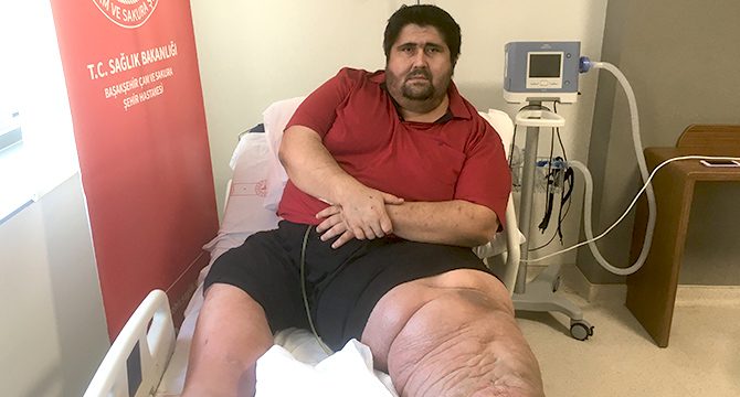 300 kiloluk adam en büyük hayalini anlattı