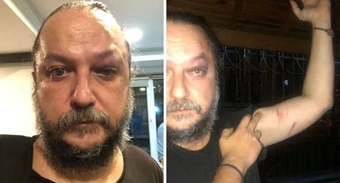 Opera sanatçısı 30 Ağustos konseri sonrası saldırıya uğradı