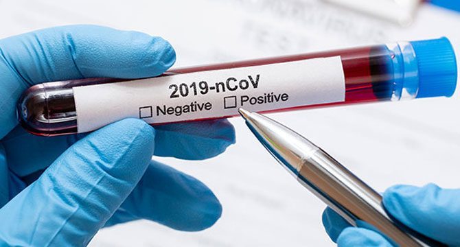 Koronavirüsü geçirenlerin yüzde 75'inde etkileri sürüyor