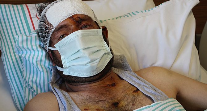 Ayı saldırısı sonucu hastanelik olan şahıs dehşet anlarını anlattı