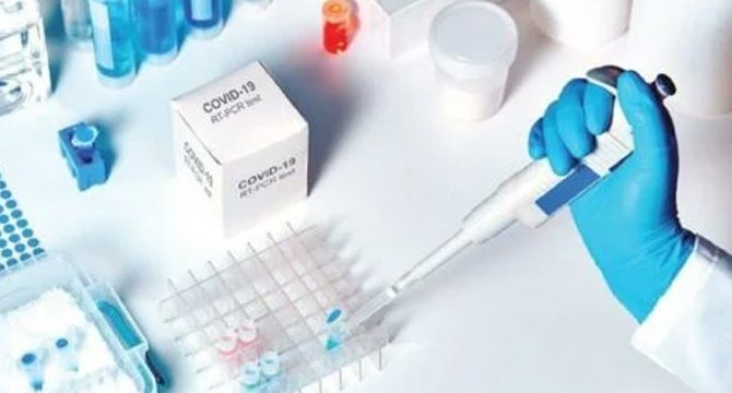 Bilim kurulu üyesinden ‘havuzlanmış PCR’ ile tarama önerisi
