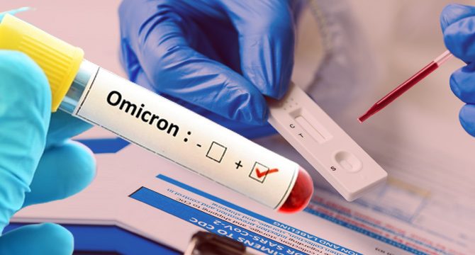Uzmanlar uyardı: Hızlı test kitleri Omicron'u tespit edebilir mi?