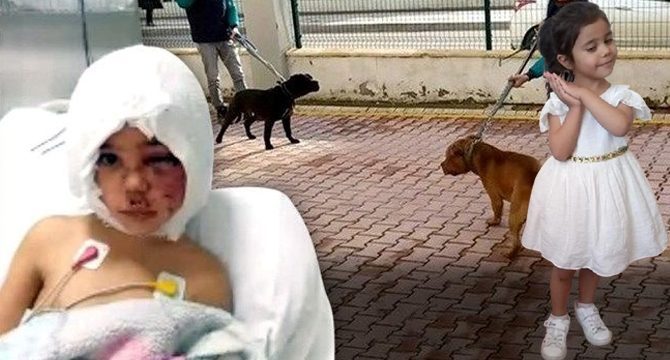 Pitbull saldırısında yaralanmıştı! Asiye Ateş'in ilk istekleri bunlar olmuş