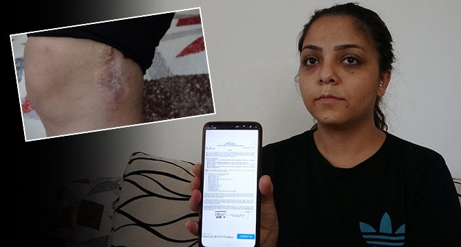 Eski kocası tarafından vurulan kadın, serbest kalmasından korkuyor
