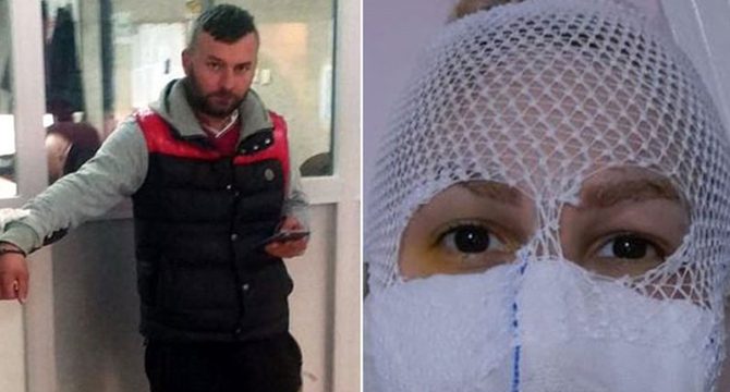 Sevgilisinin yüzüne kezzap atan adam bütün kadınlardan özür diledi
