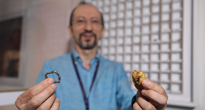 Hastane koridorunda ‘yutulan cisimler’ koleksiyonu
