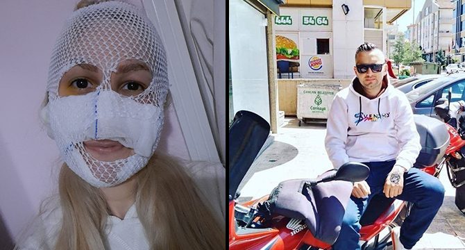 Sultan’ın yüzüne kimyasal attı, 18 yıl ceza aldı